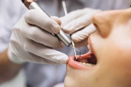 Воспаление и кариес: стоматолог рассказал об опасности неправильного прикуса