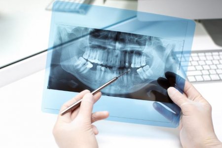 Врач Арский сообщил, что протезирование зубов может уменьшить риск деменции