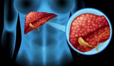 Доктор Джозеф Амбани сообщил, что ранние признаки рака печени могут проявляться во время приема пищи