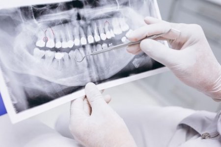 Эксперт Клоуда сообщила, какие осложнения могут возникнуть при наличии стоматологических проблем